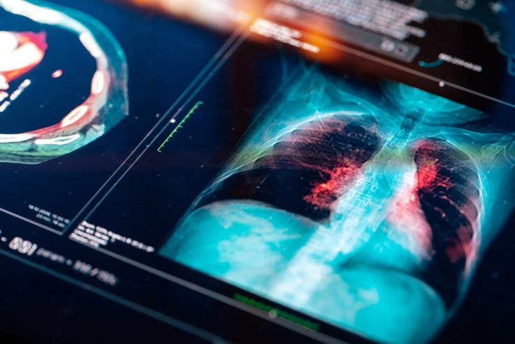 Celebrating International Day of Radiology! Card Image
